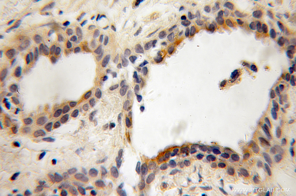 PITPNB Polyclonal antibody