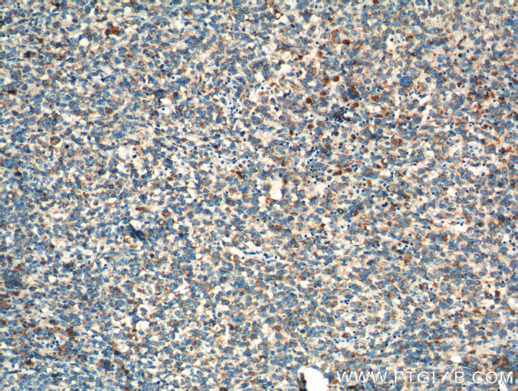 TNF Beta Polyclonal antibody