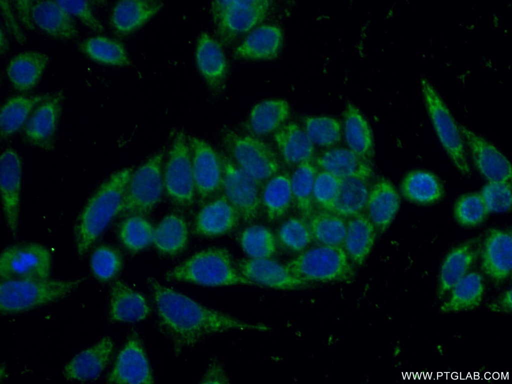 PHPT1 Polyclonal antibody