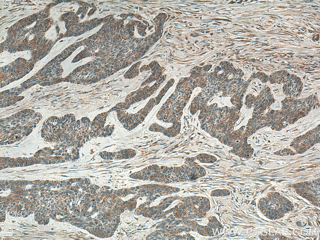 IL-36RN Polyclonal antibody