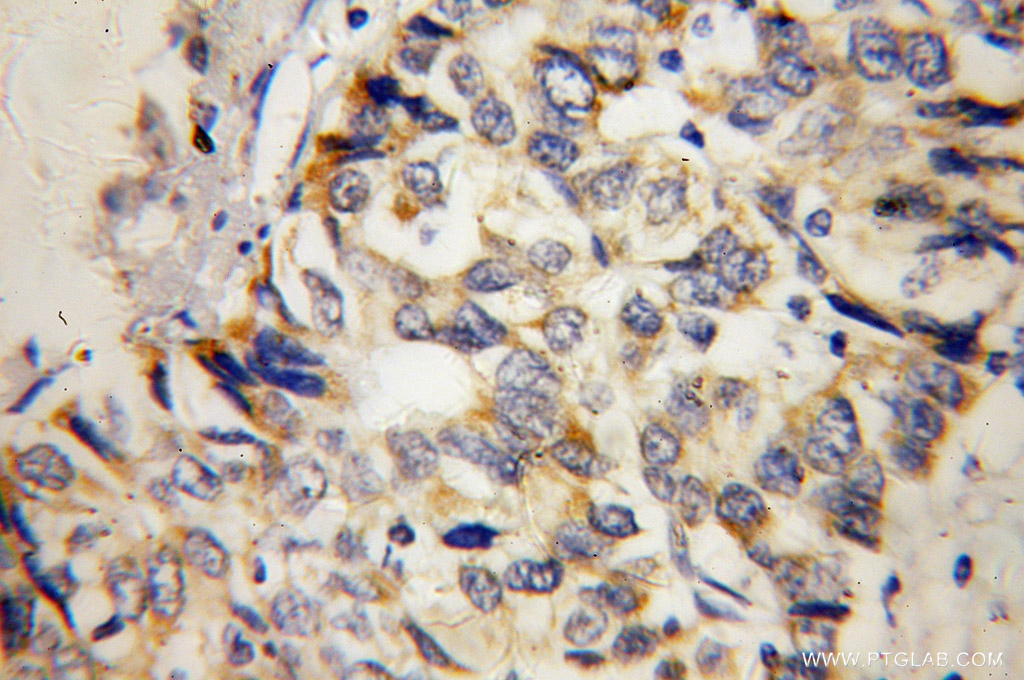 MTHFS Polyclonal antibody