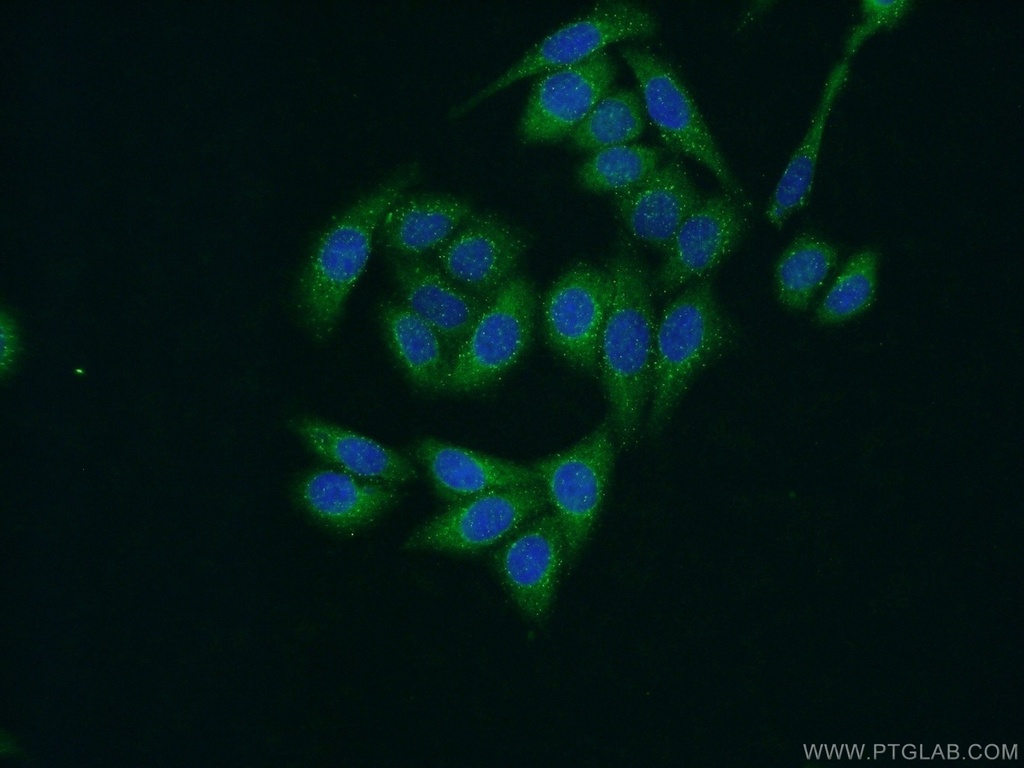 ZFYVE16 Polyclonal antibody