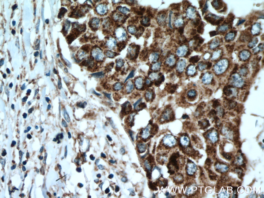 ACADSB Polyclonal antibody