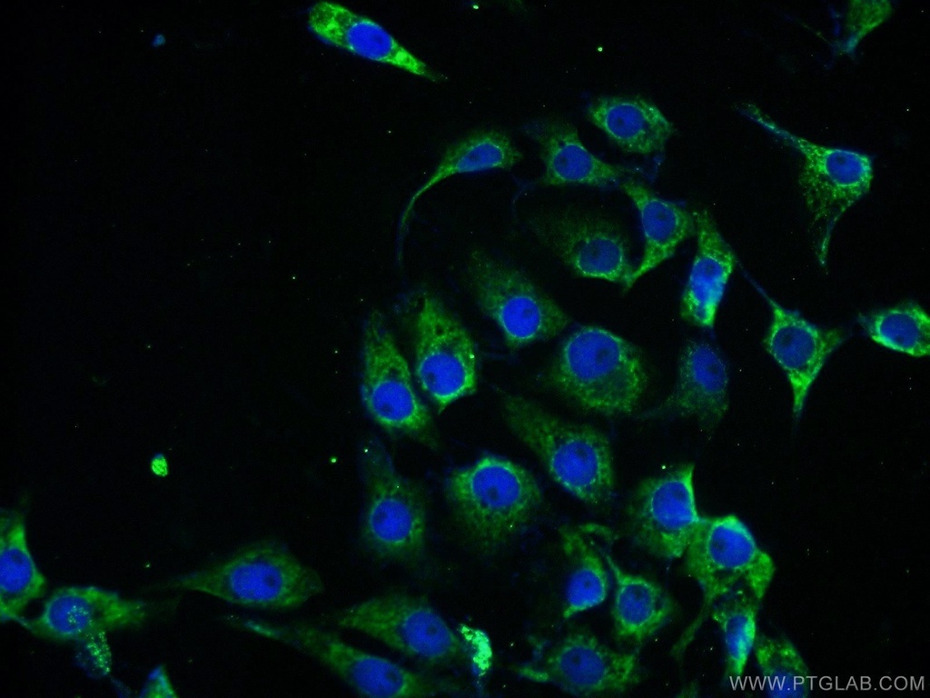 PPP2R2B/A/C/D Polyclonal antibody