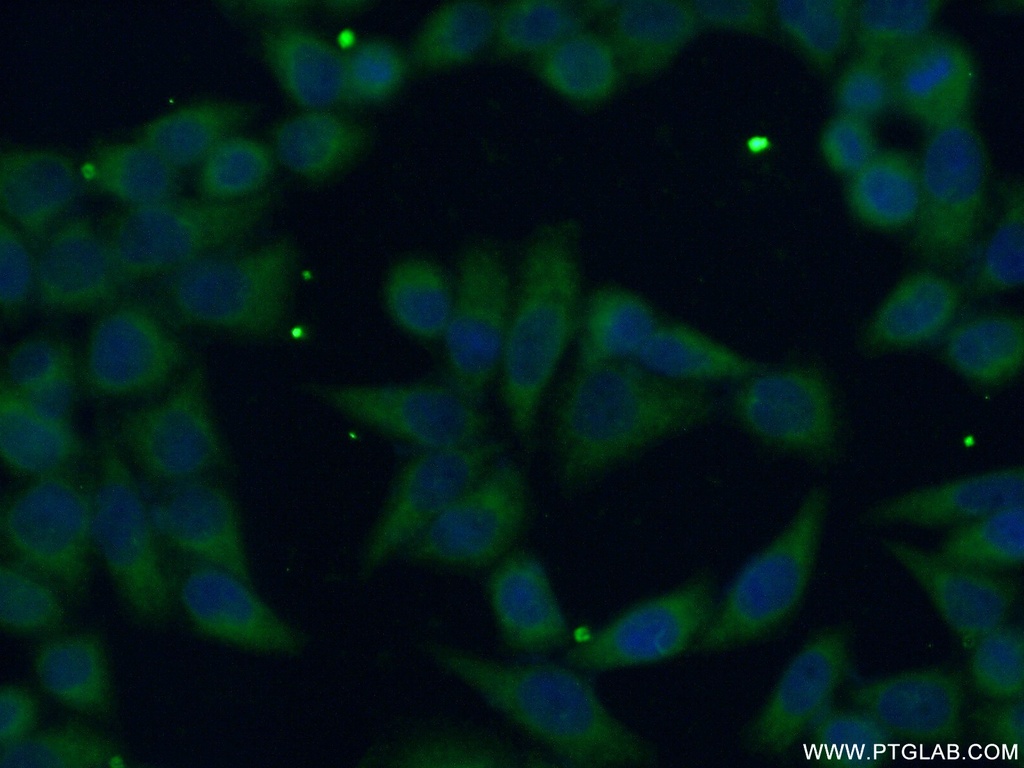 FDFT1 Polyclonal antibody
