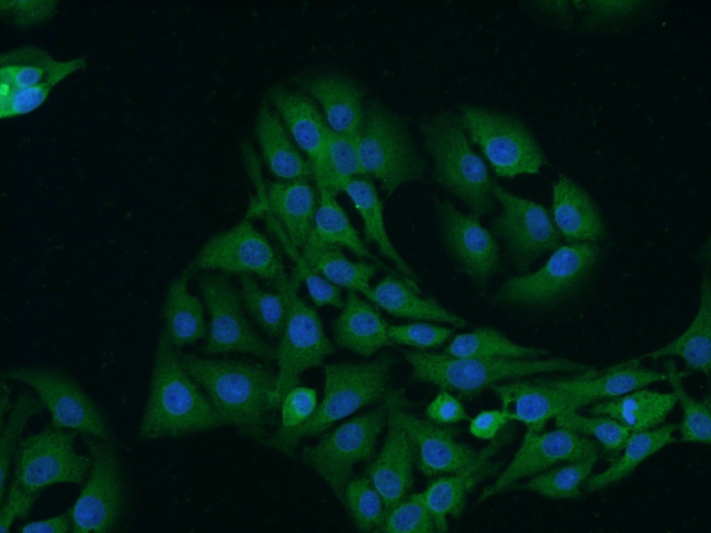 TrkB Polyclonal antibody
