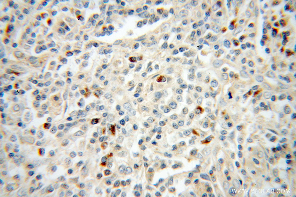 TRAV20 Polyclonal antibody