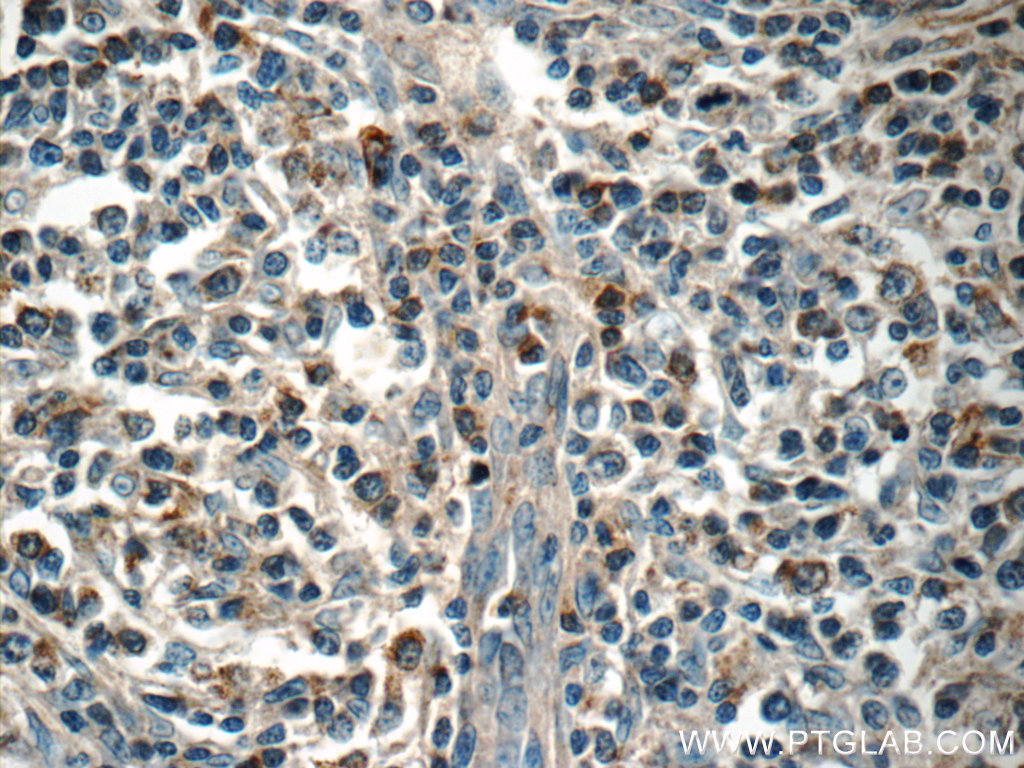 MINK1 Polyclonal antibody
