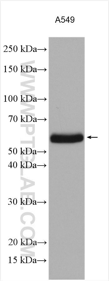 ZC3HC1 Polyclonal antibody