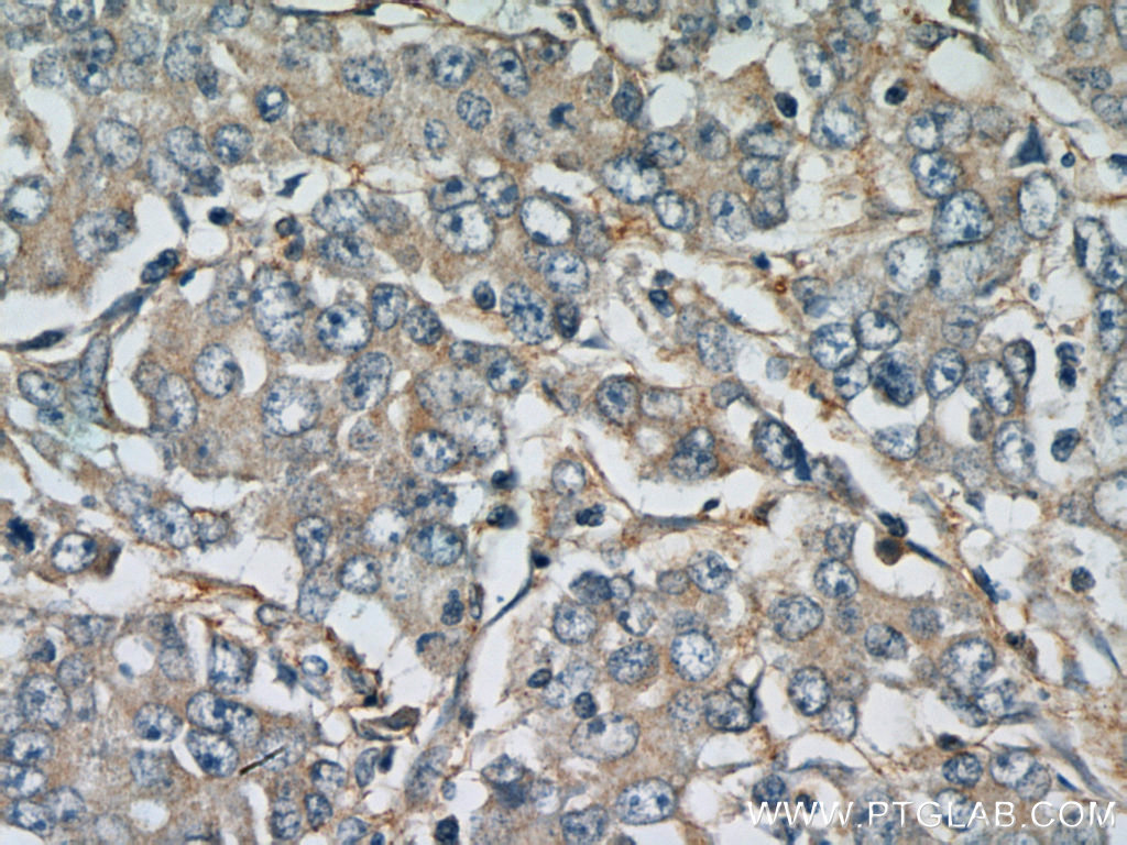 FBXW11 Polyclonal antibody