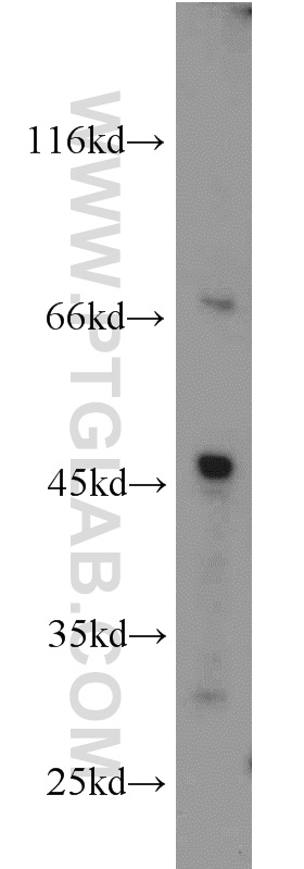 GYG2 Polyclonal antibody