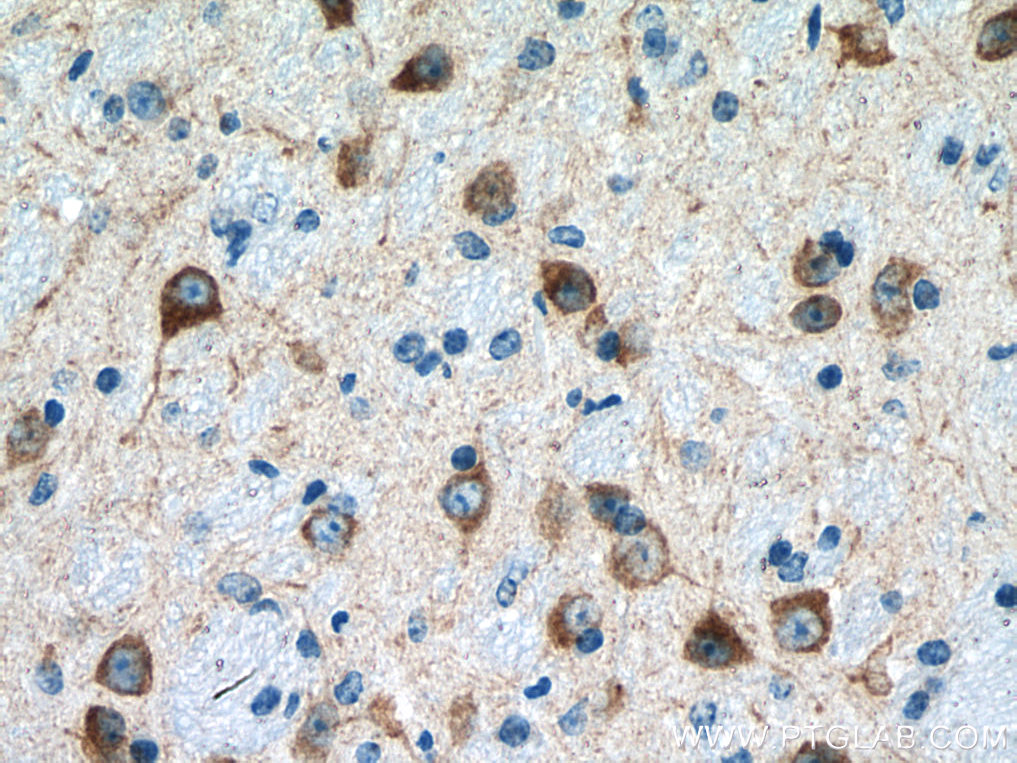 GDAP1 Polyclonal antibody