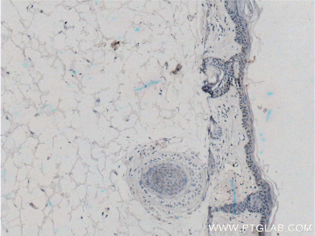 ST3GAL6 Polyclonal antibody