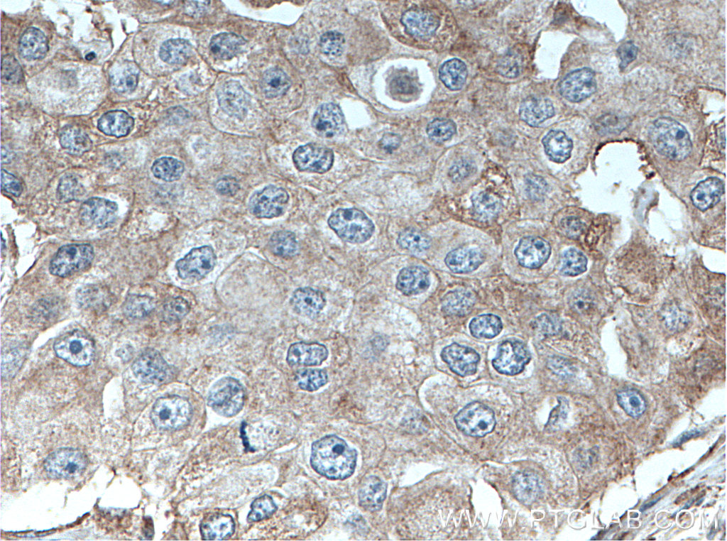 DNAJB9 Polyclonal antibody