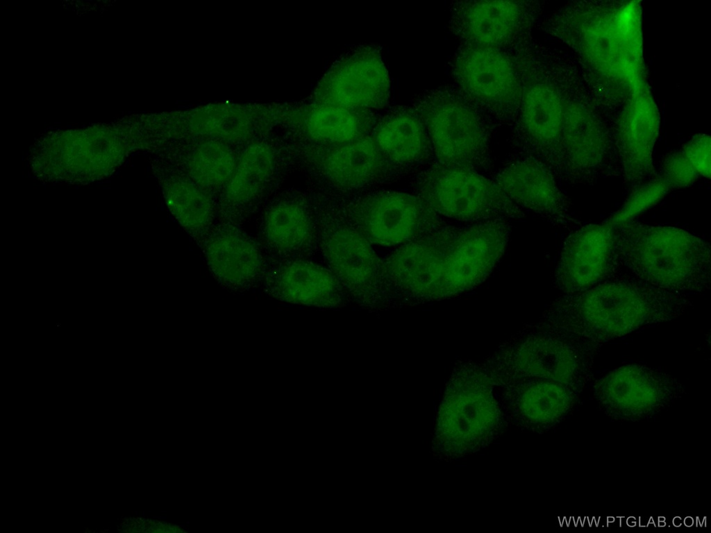SIRT1 Polyclonal antibody