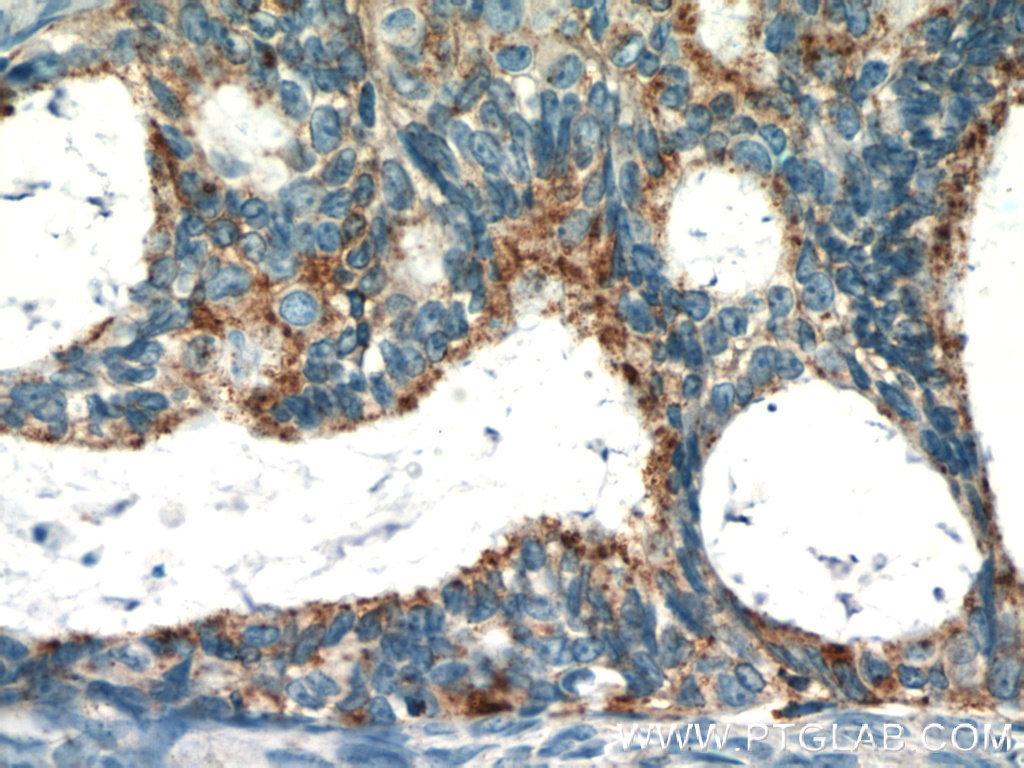 RASGRP3 Polyclonal antibody