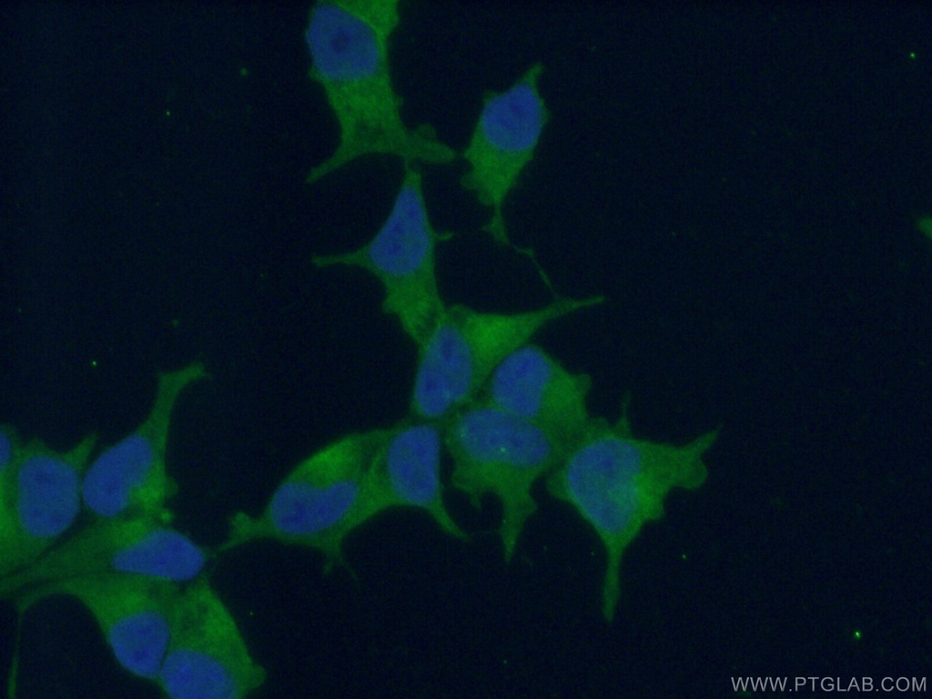 PSMA/GCPII Polyclonal antibody