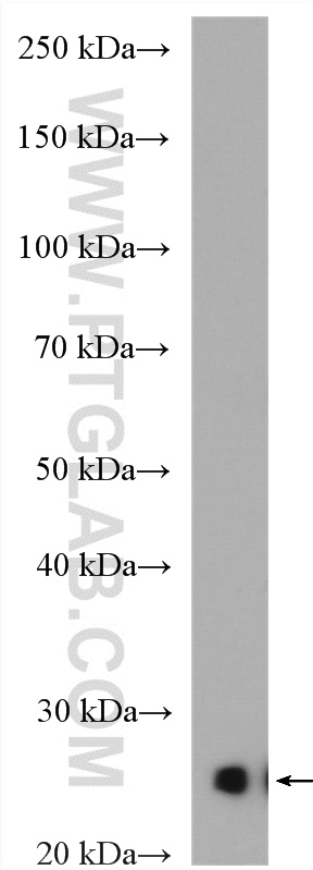 CIDEA Polyclonal antibody