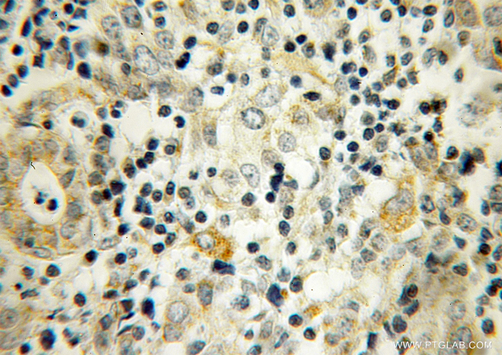 UBTD2 Polyclonal antibody