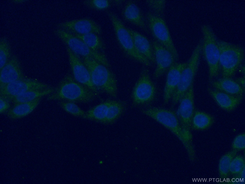 APBB2 Polyclonal antibody