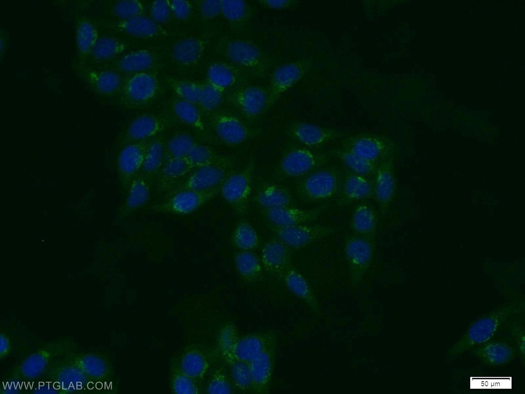 TBX4/5 Polyclonal antibody