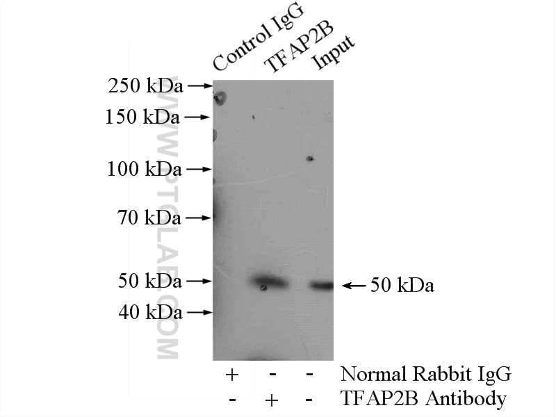 TFAP2B Polyclonal antibody