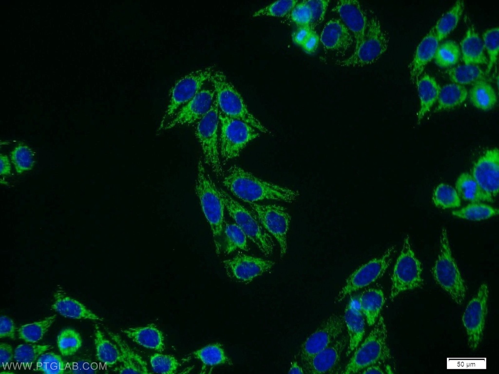 MLF1IP Polyclonal antibody
