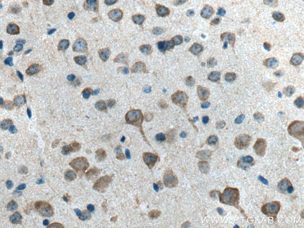Neurochondrin Polyclonal antibody