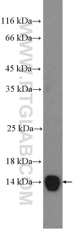 SAA Polyclonal antibody