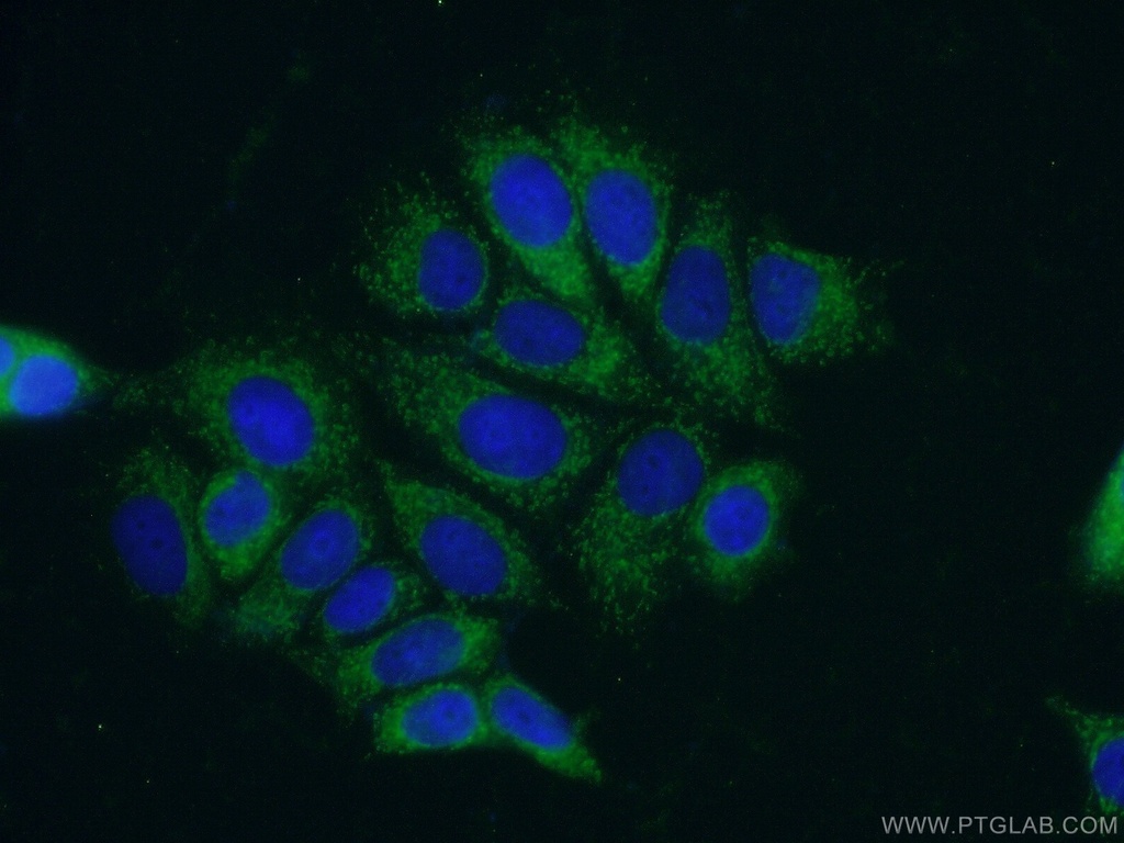 PPM1B Polyclonal antibody