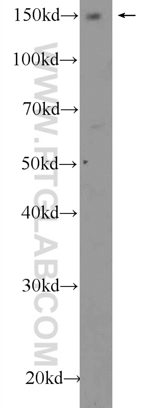 AFF4 Polyclonal antibody