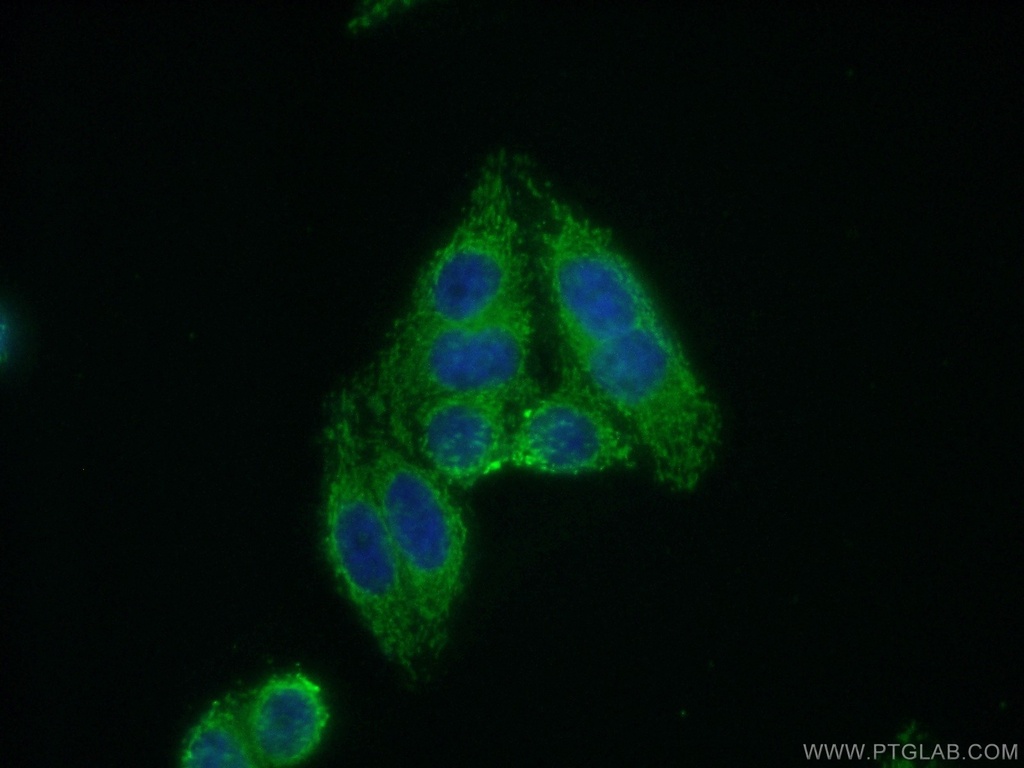 DCLRE1B Polyclonal antibody