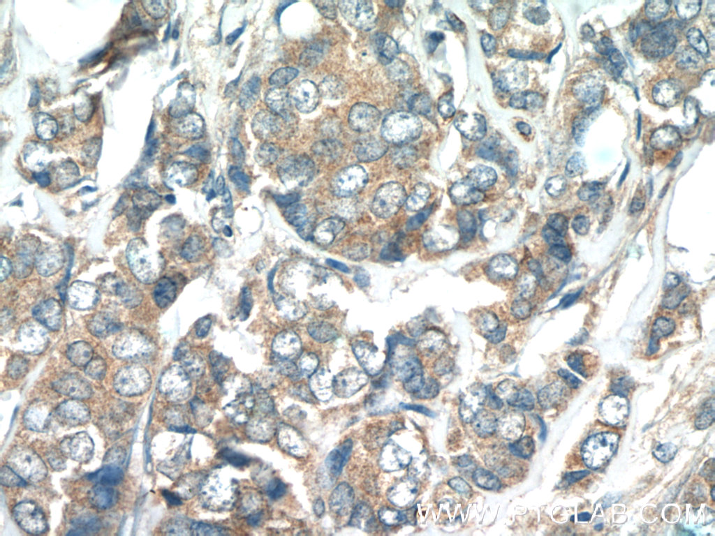 WFDC1 Polyclonal antibody