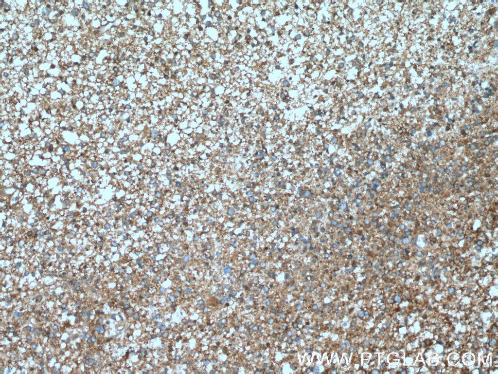 PPP3R1 Polyclonal antibody