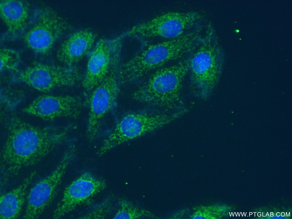 UBA6 Polyclonal antibody