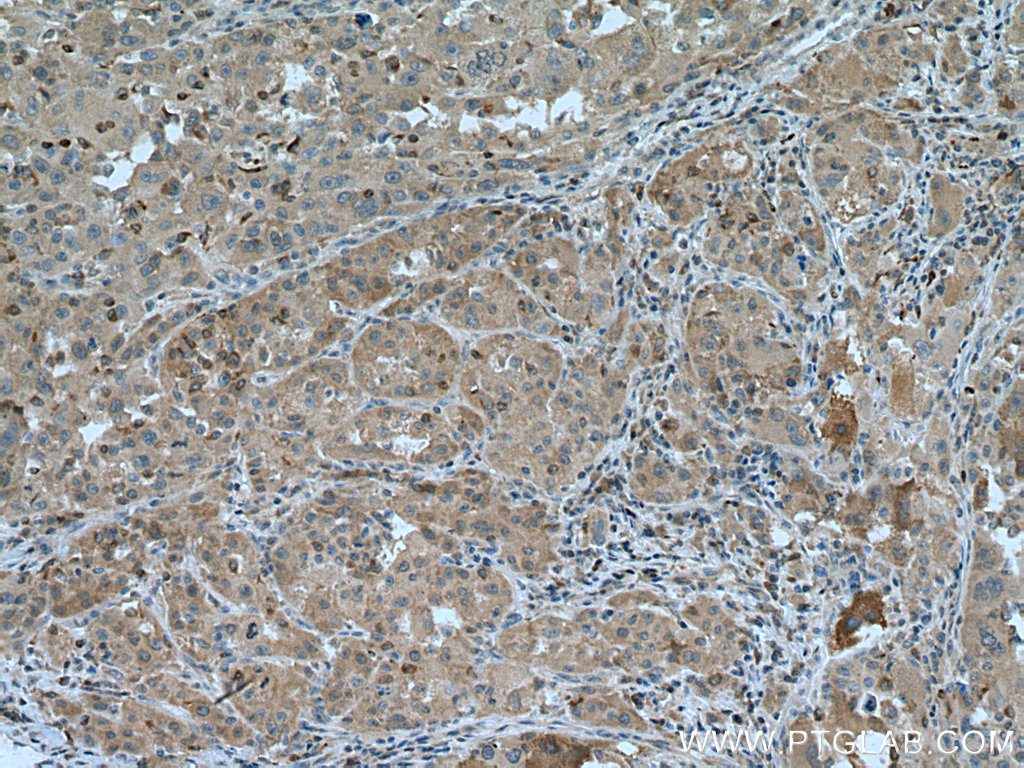 ARH Polyclonal antibody