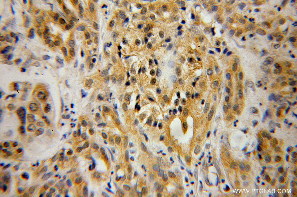 PIP4K2B Polyclonal antibody