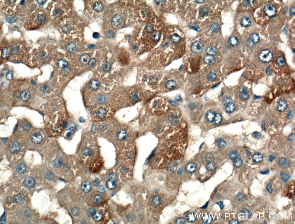 LRG1 Polyclonal antibody