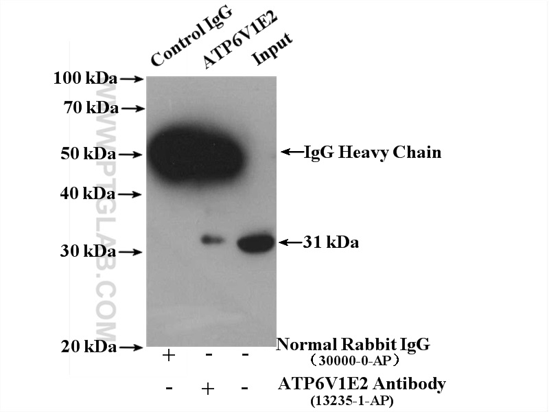 ATP6V1E2 Polyclonal antibody