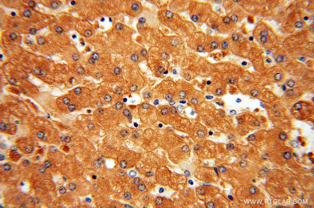 DPYS Polyclonal antibody