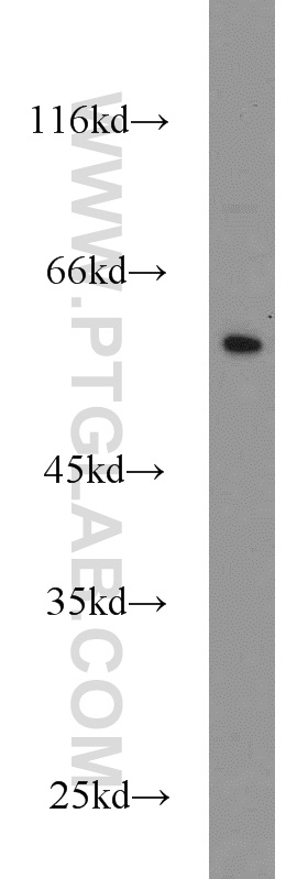CYP4F12 Polyclonal antibody