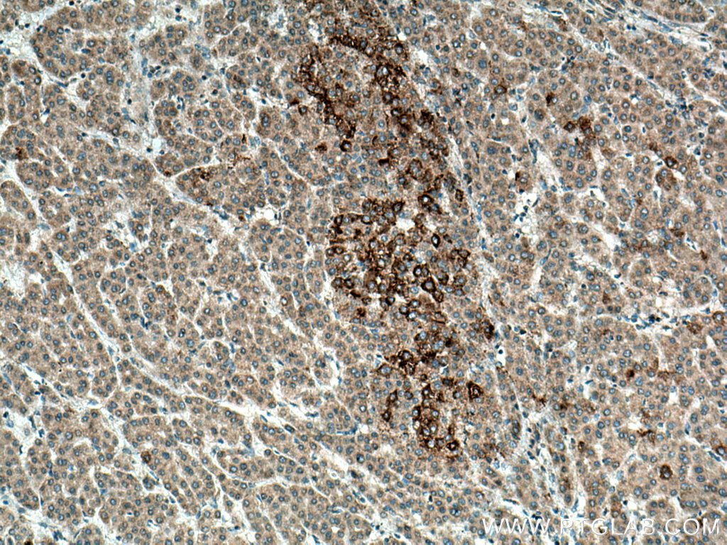 SRGAP1 Polyclonal antibody