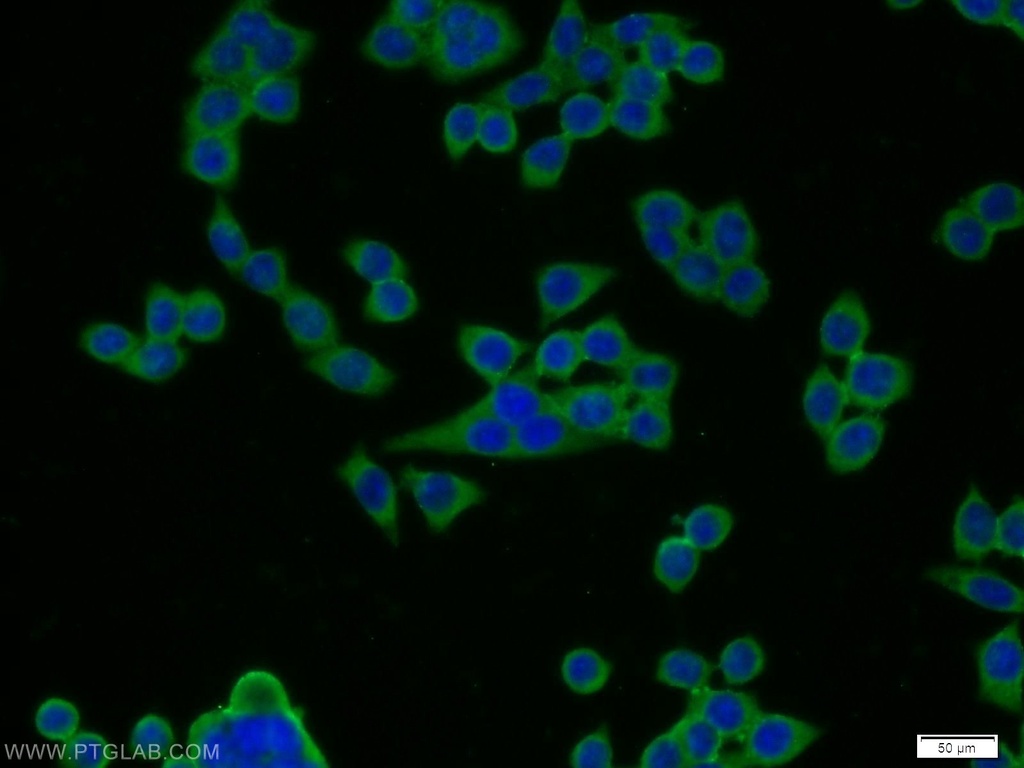 FGFBP2 Polyclonal antibody