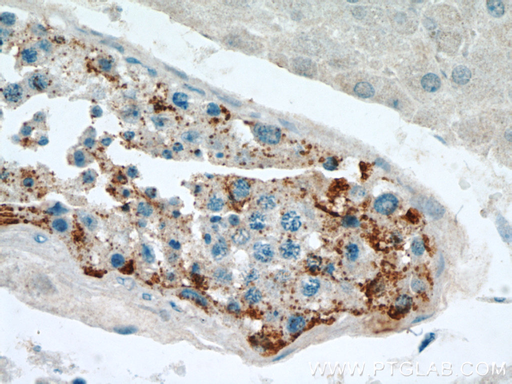 SPPL2A Polyclonal antibody