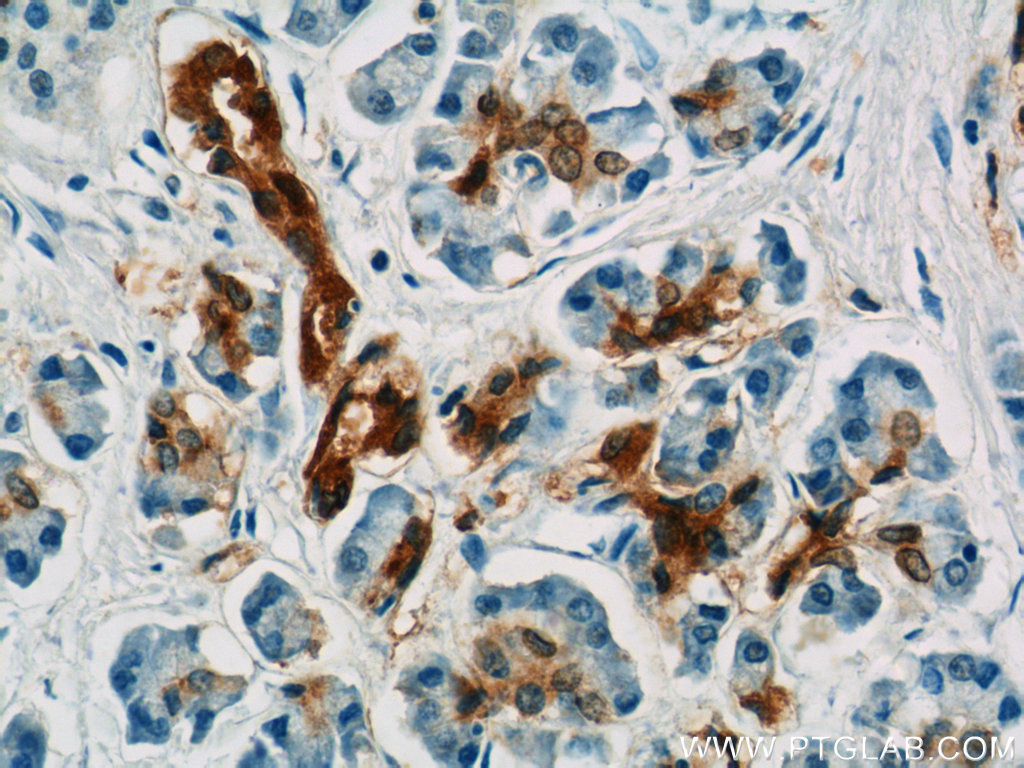 Gamma Adaptin Polyclonal antibody
