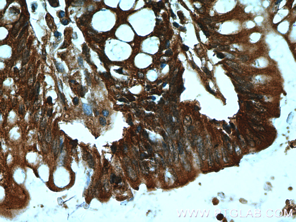 DAO Polyclonal antibody