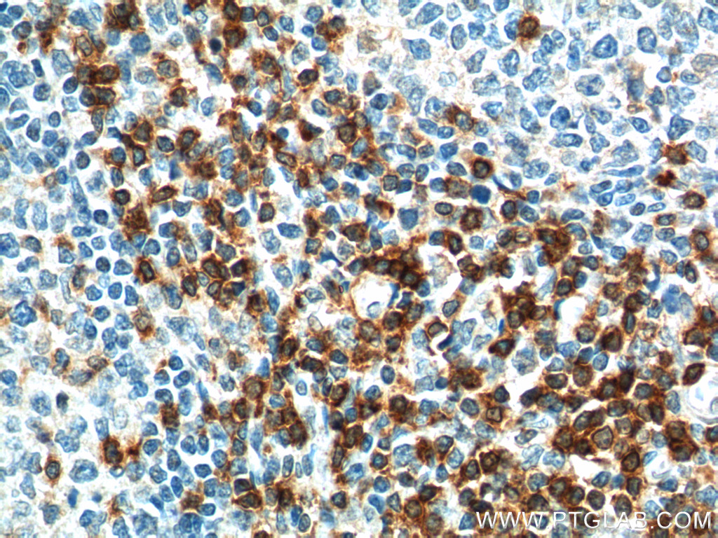 TRAT1 Polyclonal antibody