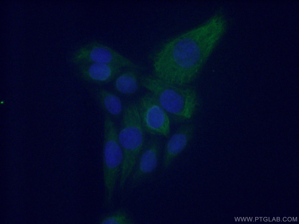 Fibromodulin Polyclonal antibody