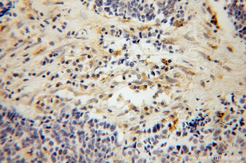 PARVG Polyclonal antibody