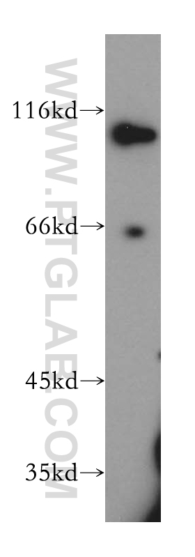 SNX25 Polyclonal antibody